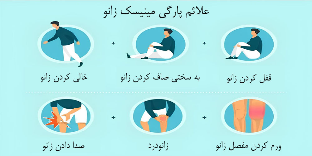 علائم پارگی مینیسک زانو 