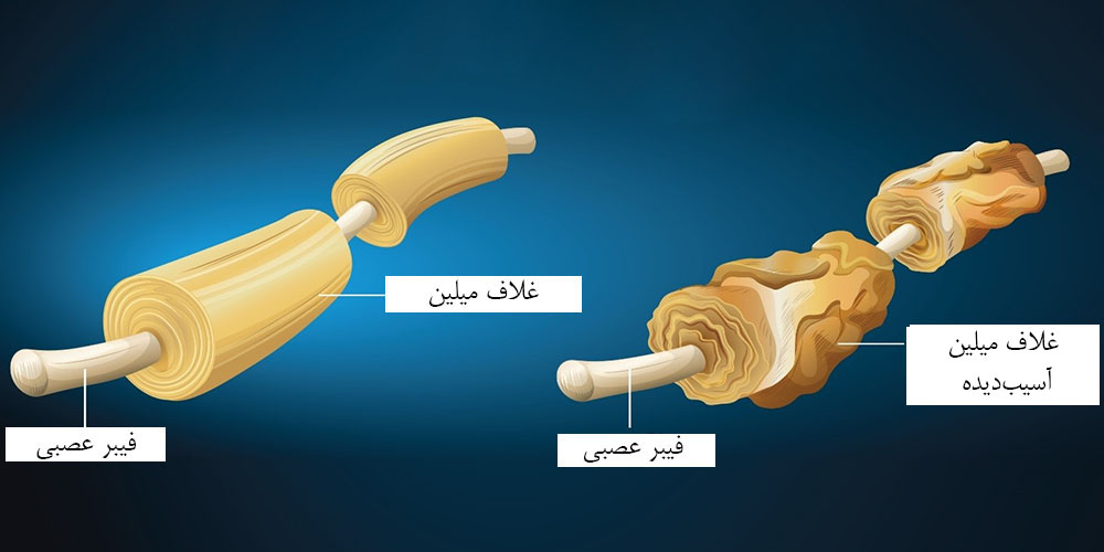 خالی شدن زانو نشانه چیست 