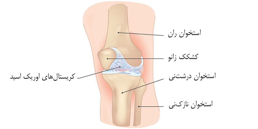 زانو درد موقع نشستن 