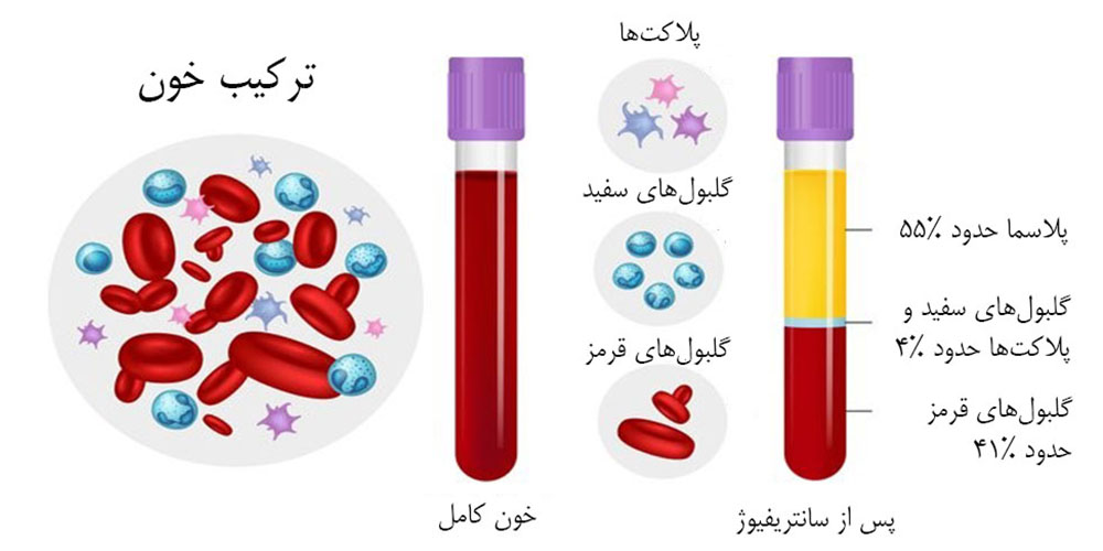 پی ار پی زانو چگونه است 