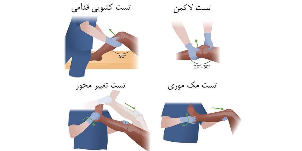  آیا پارگی رباط صلیبی قابل ترمیم است 