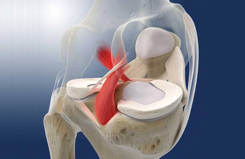 درد پشت زانو به علت کشیدگی یا پارگی رباط‌های زانو