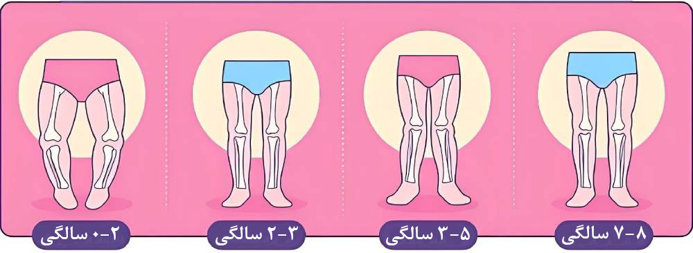 آیا زانوی ضربدری خطرناک است