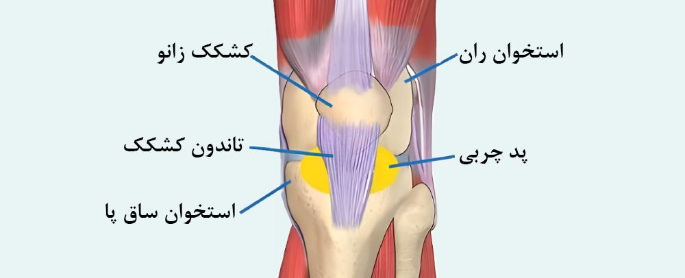 سندرم هوفا 