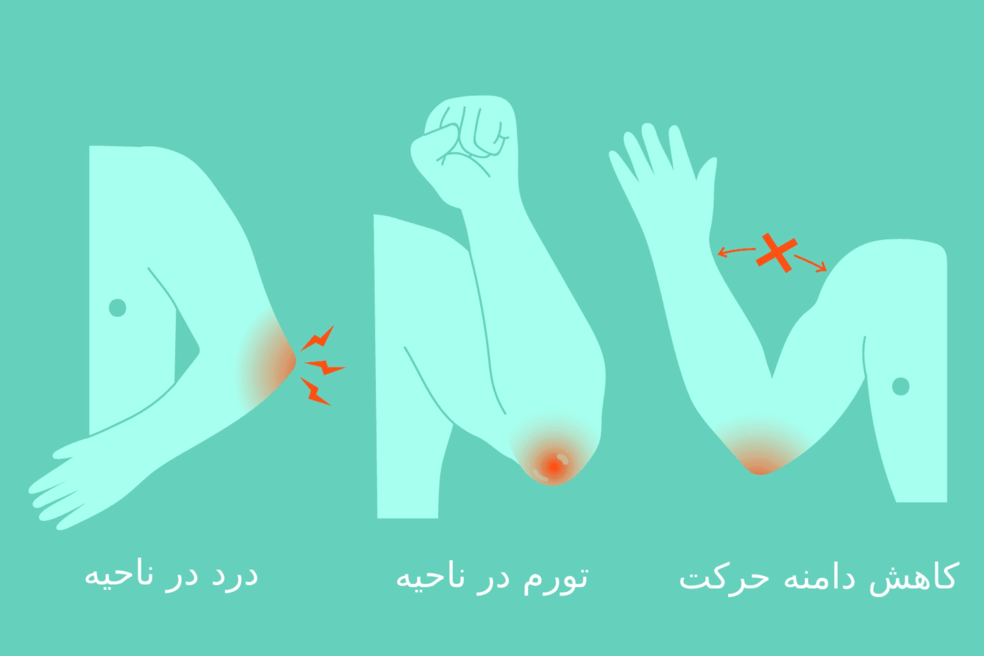 علائم بورسیت