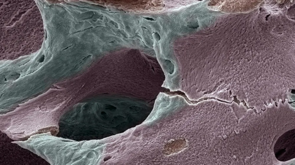 تراکم استخوان