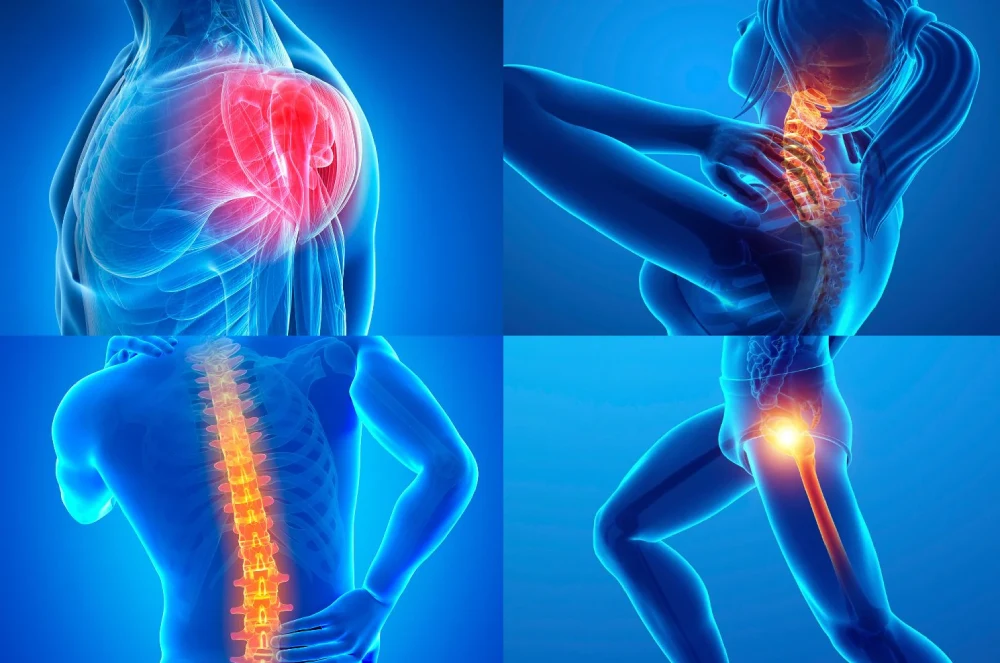 فیبرومیالژیا