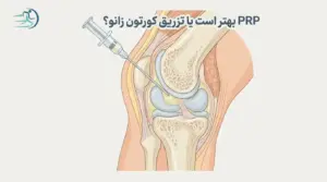 PRP بهتر است یا تزریق کورتون زانو؟